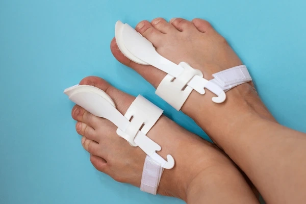 bunion correction in largo